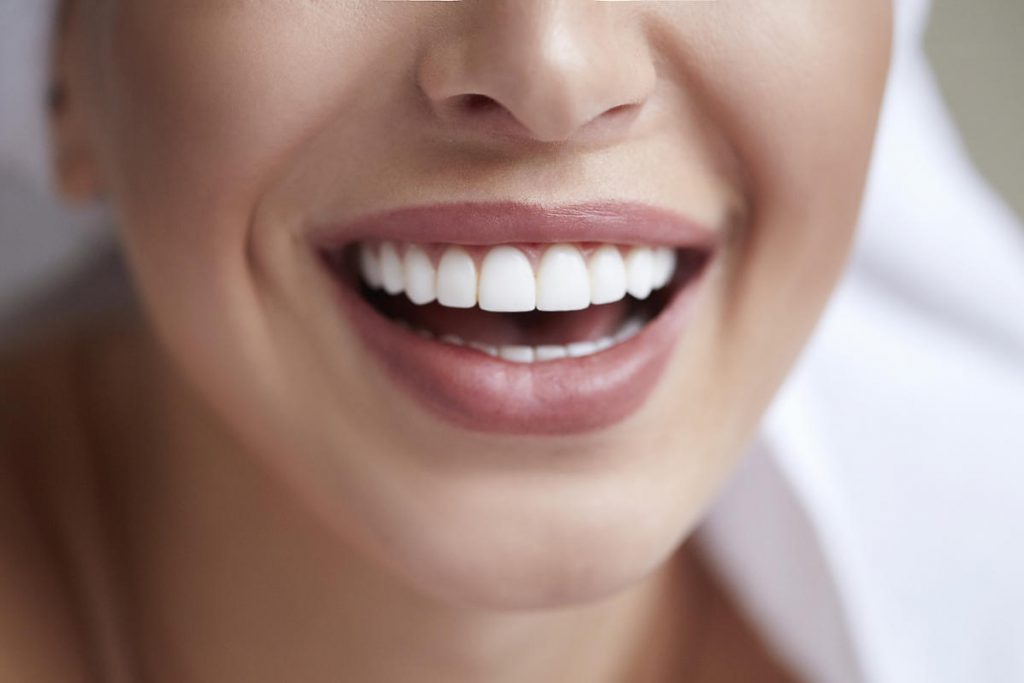 Rychlé způsoby bělení zubů z domova